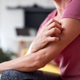 Woman itching her arm.